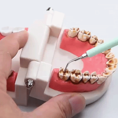 Dispozitiv de curățare dentară cu ultrasunete